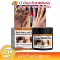 Dark Knuckles Fast Brighten Cream Elbows Hand Knuckle Brightening Serum Knee Black Skin Quickly Lighten Stains Remover Products