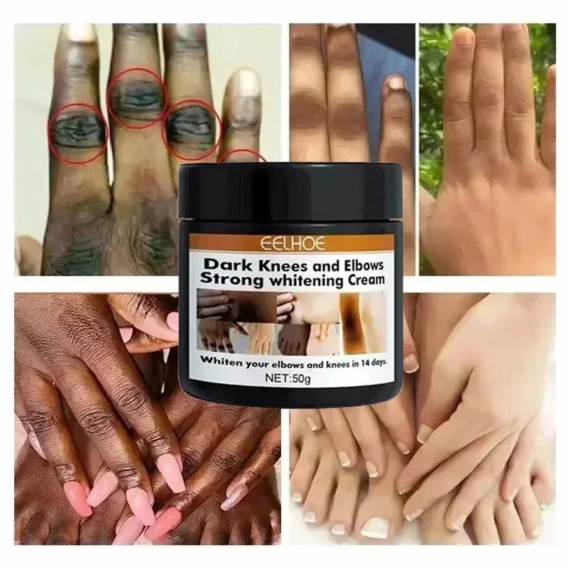 Dark Knuckles Fast Brighten Cream Elbows Hand Knuckle Brightening Serum Knee Black Skin Quickly Lighten Stains Remover Products
