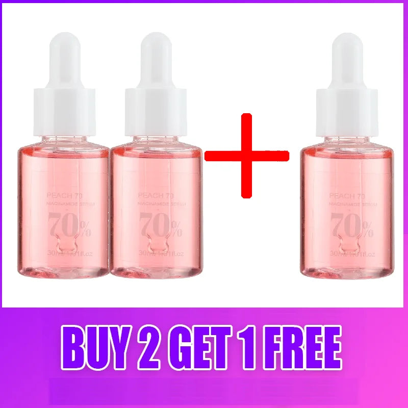 30ml Niacinamide Melanin Fading Melasma Black Spot Corrector Shrinking Pores Hyaluronic Acid Moisturizing Skincare